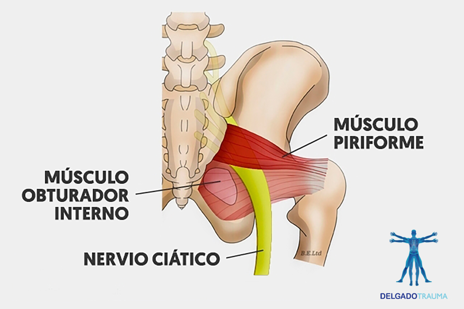 Recuperación del Piramidal con electroestimulación o pistola